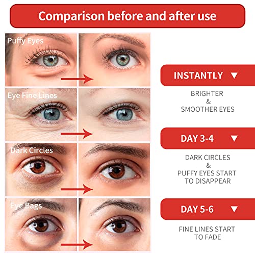 Маска за очи с червен гранат BREYLEE– 30 двойки - За лечение на отоци под очите и тъмните кръгове – вид на кожата и намалява